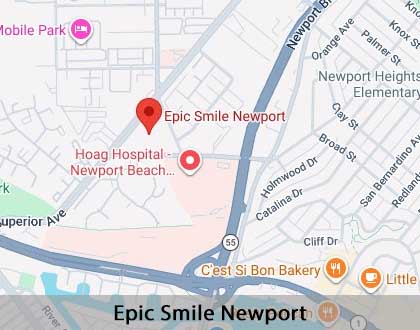 Map image for Options for Replacing Missing Teeth in Newport Beach, CA